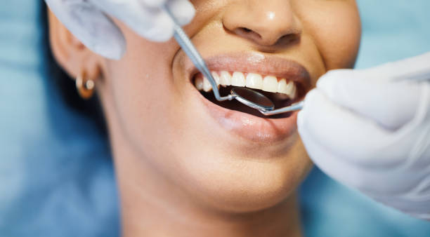 Best Emergency Dental Extractions in Weldon, NC