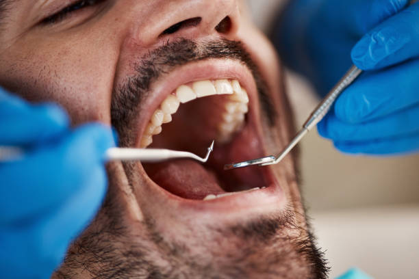Best Emergency Dental Extractions in Weldon, NC