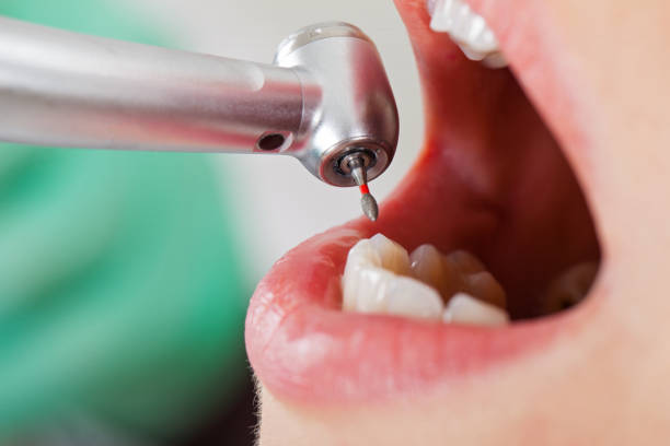 Best Broken or Cracked Tooth Emergency Dentist in Weldon, NC